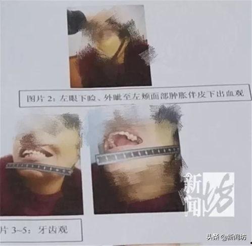 暴躁的吃瓜女子视频,网络热议背后的真相揭秘